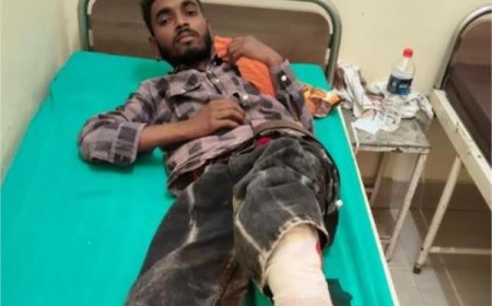 चीका फायरिंग केस में बड़ी कार्रवाई: मुख्य आरोपी एनकाउंटर में घायल, पैर में लगी गोली