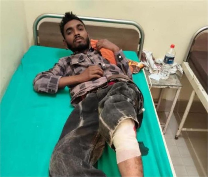 चीका फायरिंग केस में बड़ी कार्रवाई: मुख्य आरोपी एनकाउंटर में घायल, पैर में लगी गोली